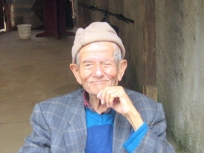 Choroba Alzheimera